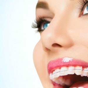 ortodontia-BANNER-dra-jessica-araujo-dentista-SJP-CURITIBA-02 ortodontia-BANNER-dra-jessica-araujo-dentista-SJP-CURITIBA-02