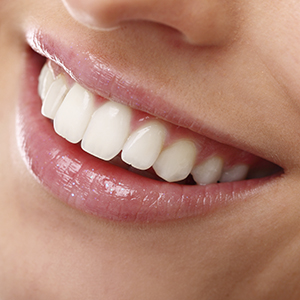 CLAREAMENTO-DENTAL-dra-jessica-araujo-dentista-SJP-CURITIBA-ARAUJO-ODONTOLOGIA-foto-02 CLAREAMENTO-DENTAL-dra-jessica-araujo-dentista-SJP-CURITIBA-ARAUJO-ODONTOLOGIA-foto-02