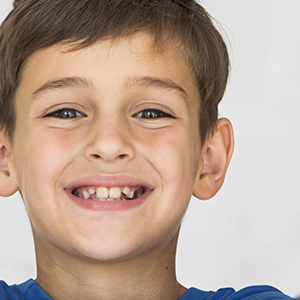 PERIODONTIA-dra-jessica-araujo-dentista-ARAUJO-ODONTOLOGIA-SJP-CURITIBA-TRATAMENTO-02 PERIODONTIA-dra-jessica-araujo-dentista-ARAUJO-ODONTOLOGIA-SJP-CURITIBA-TRATAMENTO-02