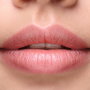 preenchimento-labial-acido-hialuronico-BANNER-dra-jessica-araujo-dentista-SJP-CURITIBA-TRATAMENTO-02 preenchimento-labial-acido-hialuronico-BANNER-dra-jessica-araujo-dentista-SJP-CURITIBA-TRATAMENTO-02